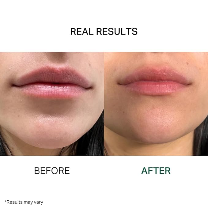 Y’OUR Intensive Lip Balm | Light-Weight & Comforting | with Natural Shea Butter & Rosehip Oil | Extreme Moisturizer for Dry Lips | Paraben-Free & Silicon-Free Lip Care Products | 15ml (0.5 oz.)