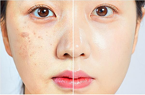 ULTIMATE (0.4%) Retinoid (liposome) Cream ┃Line Lifting and Rejuvenation Concentrate (30ml/1oz)