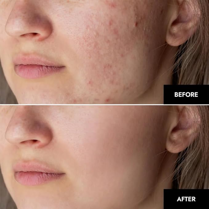 Youth Bio-Collagen Overnight Face Mask - Youth Skin Collagen Mask, Korean Glass Skin Face Masks Skincare, Hydrating Overnight Hydrogel Mask, Pore Minimizing, Elasticity Improvement (34gx8ea)