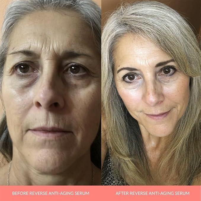 AnnieMak Reverse Anti Aging Serum for Face, Deep Moisturizer Skin Care for Women, Helps Reduce Wrinkle, Dark Spots & Facial Lines, Moisturizing & Hydrating, Promotes Collagen (1 fl oz)