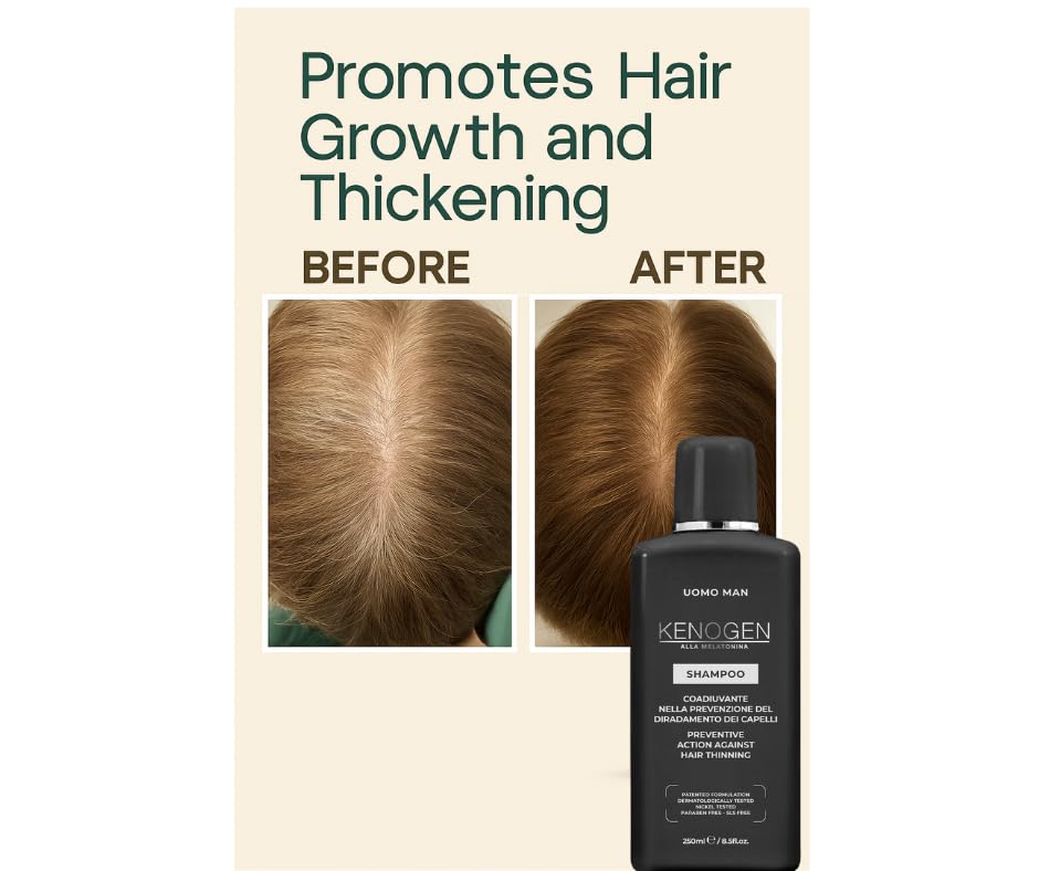 Kenogen Hair Growth Shampoo for Men – Thickening & Volumizing for Thinning Hair – Stimulates Follicles & Regrowth with Melatonin – DHT Blocker – Vegan, Sulfate-Free, Cruelty-Free Formula