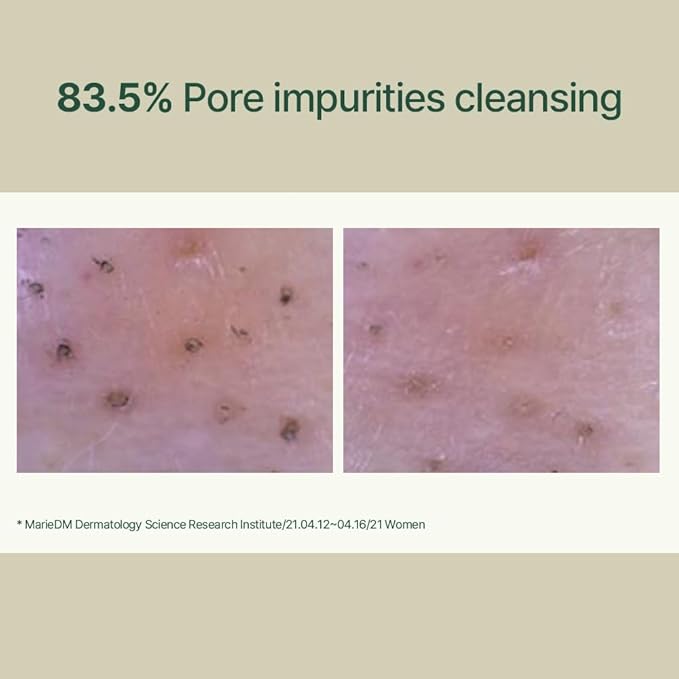 Pyunkang Yul Calming Low pH Foaming Cleanser | Daily Face Wash & Makeup Remover with Tea Tree, Centella Asiatica, 5 Hyaluronic Acids that Removes Dead Skin Cells, Hydrates Skin - 150ml 5.07 Fl.Oz.