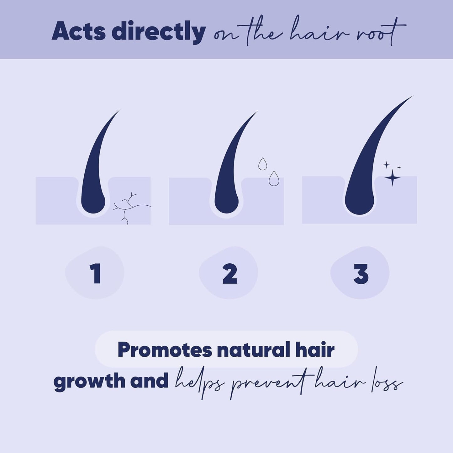 MOERIE Ultimate Hair Growth Serum for Natural Hair Regrowth & Thickening - Anti Thinning & Hair Loss Treatment for Women - Rapid Hair Growth Products (1.69 Fl Oz (Pack of 3))