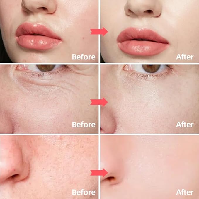 SORYA Skin Care Retinol Facial Moisturizer Hydrating with Hyaluronic Acid, Skincare Face Cream to Reduce Wrinkles Powerful Day and Night Anti-Aging Cream