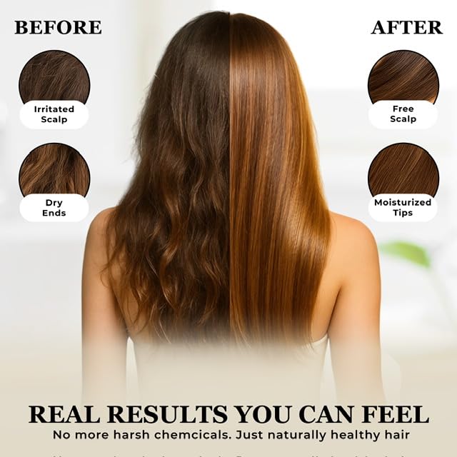 Castor Oil Shampoo and Conditioner Set - Made in USA, 10 oz Bottles