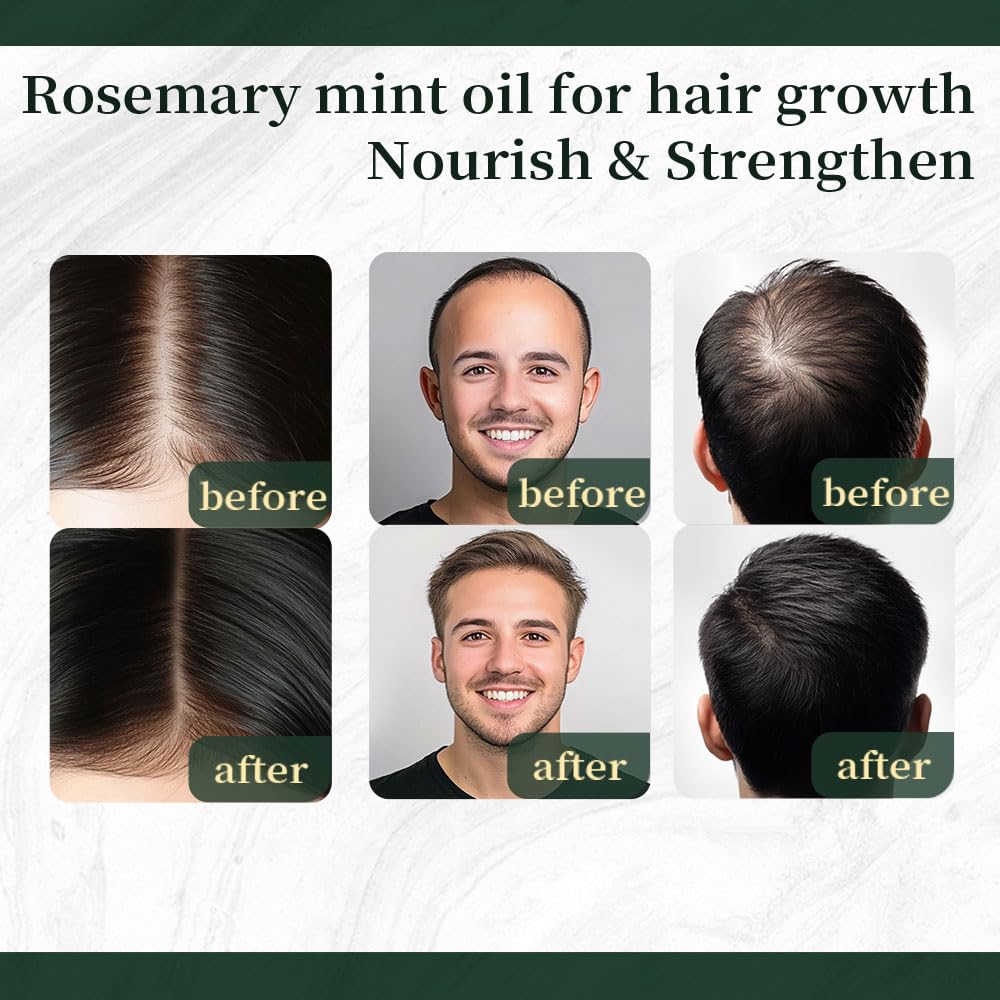 NP NATURES PHILOSOPHY Rosemary Mint Hair Growth Oil, Stimulates Hair Regrowth, Anti-Hair Loss, Nourishing Scalp Treatment for Thicker Fuller Hair, Aussie Hair Growth Products for All Hair Types