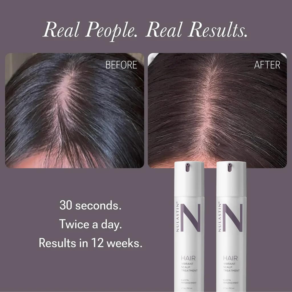 NULASTIN Scalp Serum - Vibrant Scalp Treatment to Help Improve the Look of Hair Density - Lightweight, Fast Absorbing Formula Enriched with Hair-Strengthening Ingredients (2 Count)