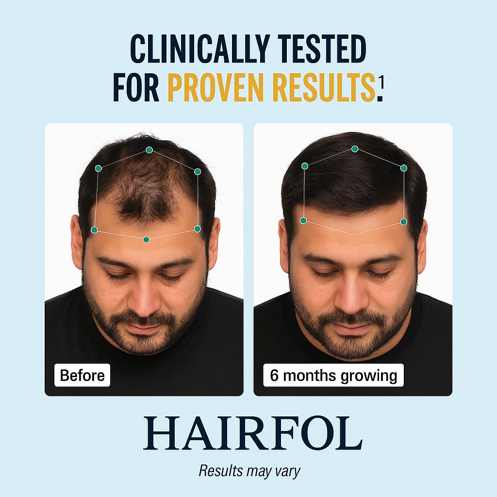 Men's Hair Growth Supplement – Clinically Tested Hair Growth Vitamins for Men, Thicker Hair & Scalp Coverage, Hair Regrowth Support for Men – Stronger, Fuller Hair – 1 Month Supply