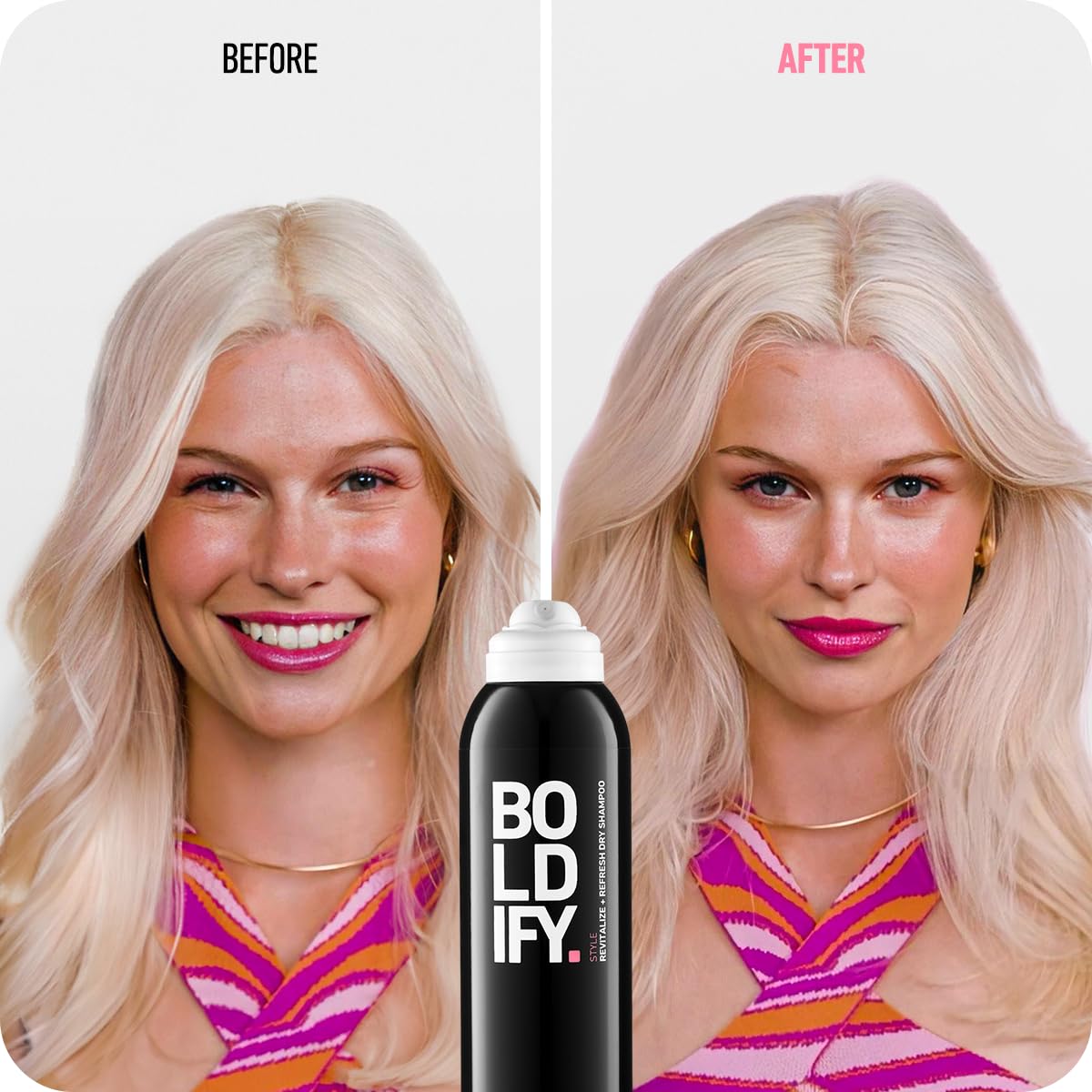 Boldify Dry Shampoo Spray - Revitalize and Refresh - Instantly Cleans, Volumizes and Balances Scalp, with Scalposine and Rice Starch - Invisible, Lightweight Formula for All Hair Types