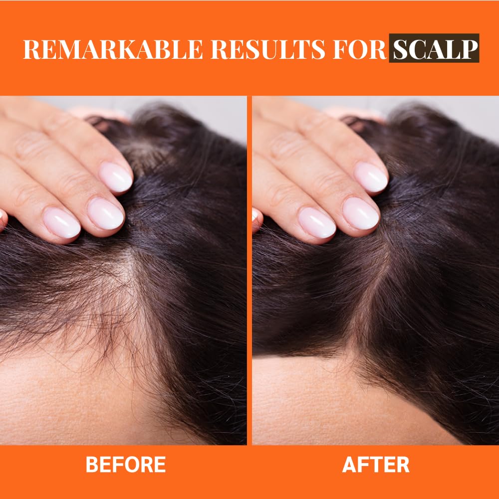 Well's Oil Batana Oil | 4 fl. oz. | 100% Natural Organic Raw Batana from Honduras | Dr. Sebi Approved | Strengthens, Hydrates & Nourishes | For All Hair Types (4 fl. oz. / 118 ml)