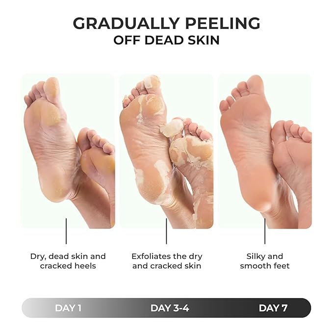 Happy Feet Foot Peel Mask, 03 Pack Original Exfoliant Foot Mask, Callus Remover for Rough Cracked Dry Feet Dead Skin, Gift for Mom Dad