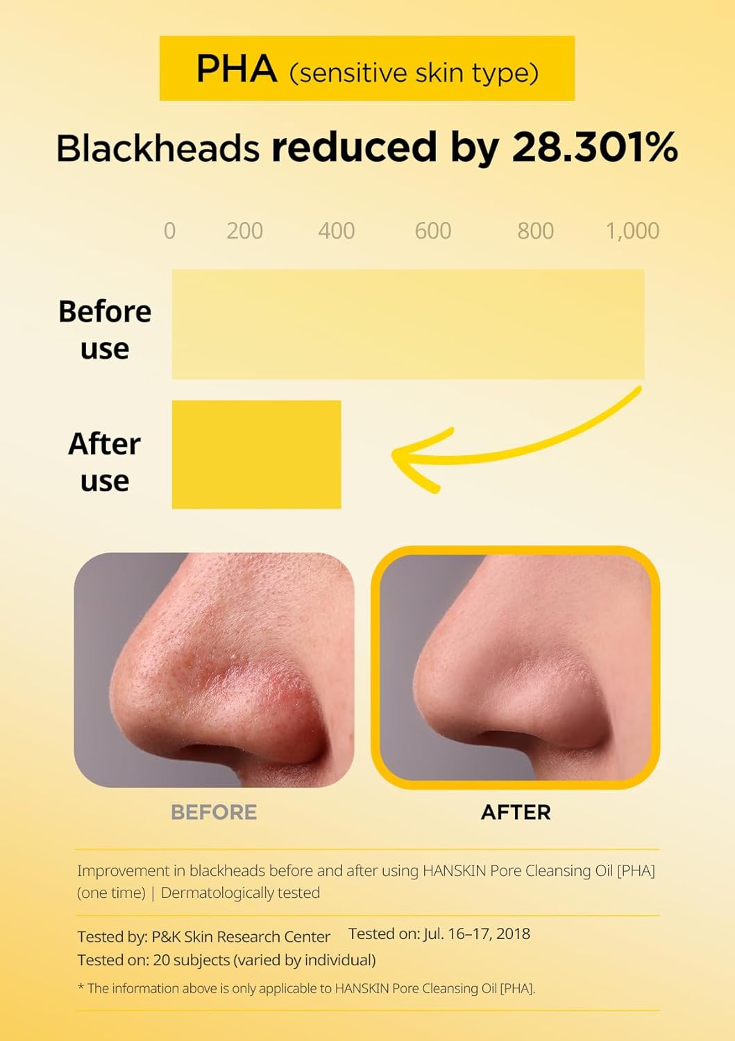 Hanskin Pore Cleansing Oil, Oil Cleanser for Face, Makeup Blackhead Remover, Korean Cleanser for Sensitive Skin (6.76 oz (Pack of 1))