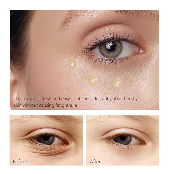 Retinol Eye Serum, Anti-Aging with Hyaluronic Acid Vitamin E Ceramide for Dark Circle, Fine Lines & Under Eye Bags Visibly Reduces, 1.02 fl.oz