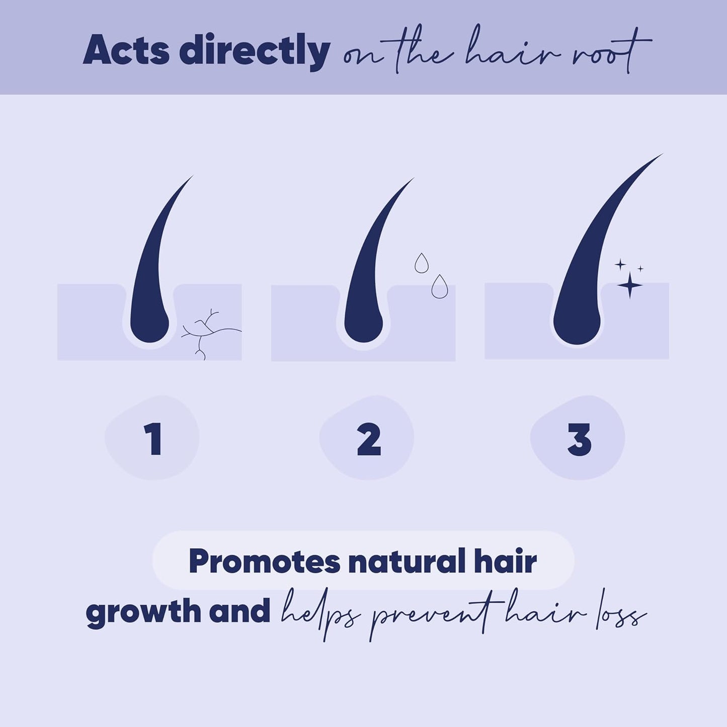 MOERIE Ultimate Hair Growth Serum for Natural Hair Regrowth & Thickening - Anti Thinning & Hair Loss Treatment for Women - Rapid Hair Growth Products - Scalp Oil Alternative - 1.69 fl oz / 50 ml