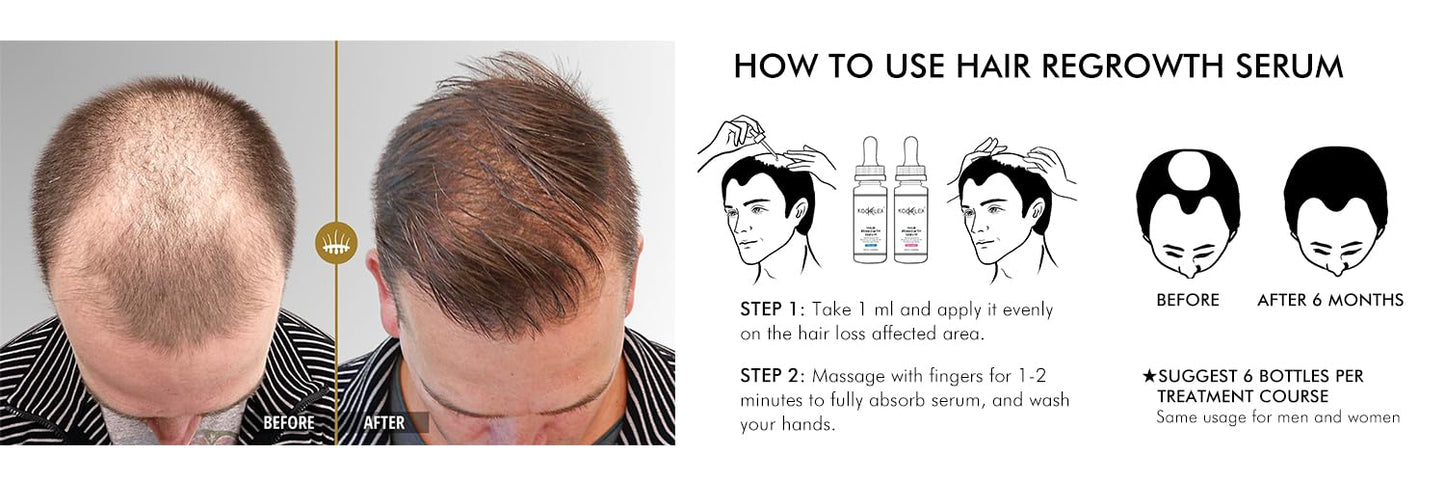 5% Minoxidil Hair Regrowth Serum for Men – Extra Strength Treatment with Biotin – Promotes Regrowth, Fights Hair Loss & Thinning, Stimulates Scalp for Fuller Hair – 60mL x3 Pack