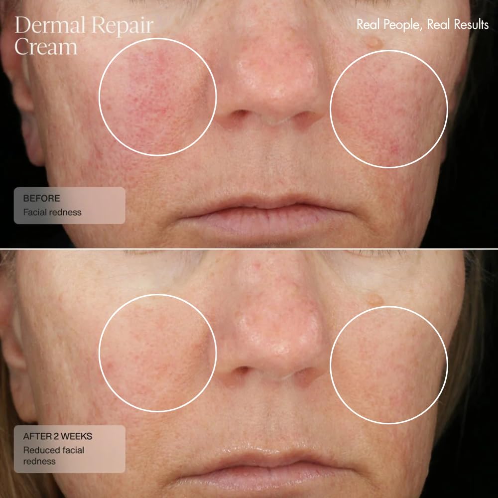 Senté The Repair Duo with Bio Complete Serum & Dermal Repair Cream - AntiAging Skincare Kit for Sensitive Skin, Fine Lines & Wrinkles, Redness & Deep Hydration.With Retinol & Vitamin E(1.0oz & 1.7oz)