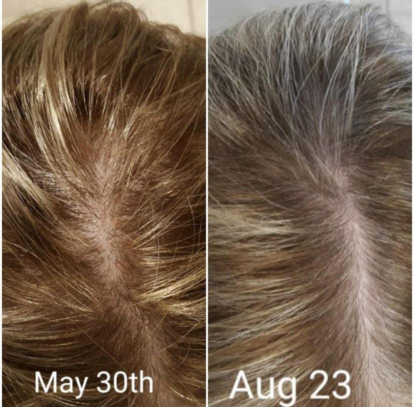 CRISAN 16oz Extreme Hair Growth and Strengthening Oil for Men and Women (16 fl oz)