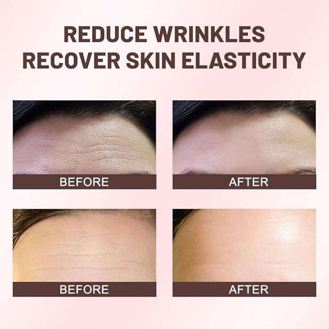 Kaely 12Pcs Forehead Wrinkle Patches,Facial Anti Wrinkle Patches with Collagen,Face Tape for Wrinkles for All Skin Types,Smooth Fine Lines & Wrinkles