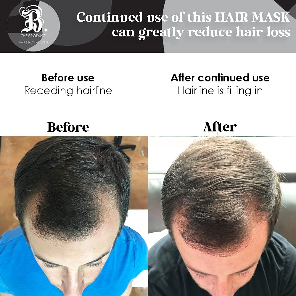 Biotin and Hydrolyzed Collagen Hair Mask for Dry & Damaged Hair with Aloe Vera, Avocado Oil, Vitamin E Oil (8oz)