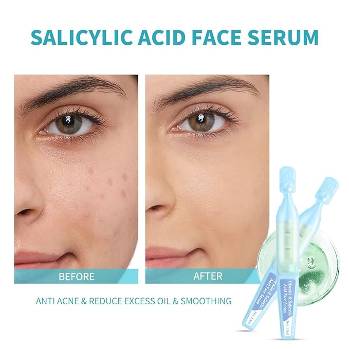 Salicylic Acid Serum for Face with Glycolic Acid, Azelaic Acid, Redness Relief, Hydrating & Smoothing Serum, Anti Aging Facial Serum, 5 Ampoules