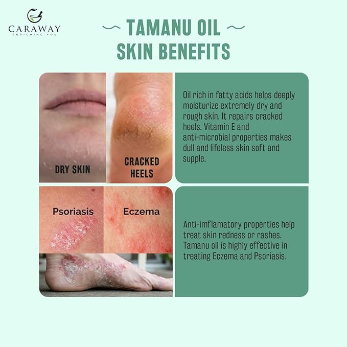 CARAWAY Tamanu Oil Organic for Skin - Cold Pressed - Natural Moisturizer for Dry Skin, Face and Hair - Helps Treat Hyperpigmentation, Acne scars, Eczema, Psoriasis- 1.7 Fl oz - 50 ml