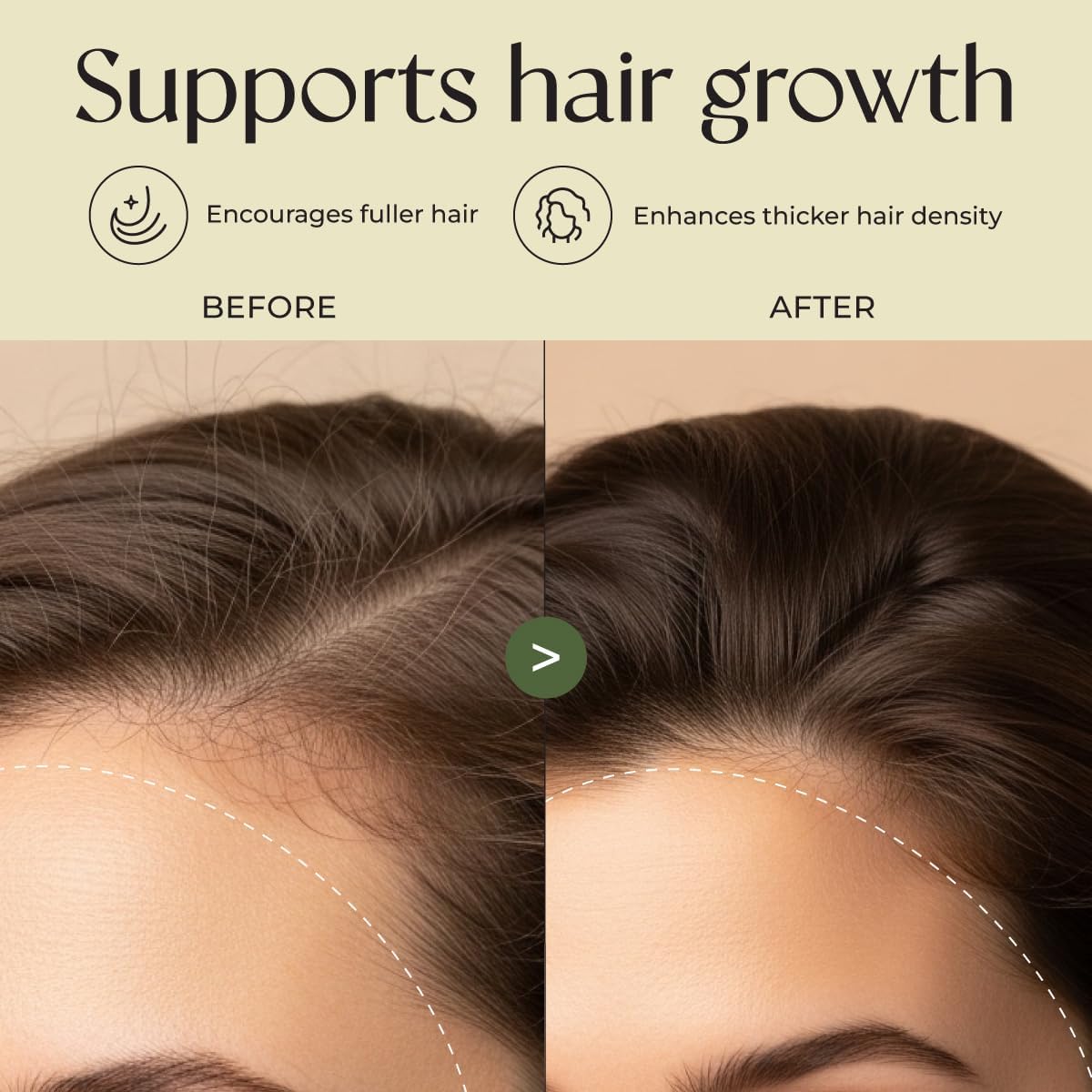 Gya Labs Rosemary & Castor Hair Oil - 4 Fl Oz - for Scalp Health, Strengthens & Protection from Damage