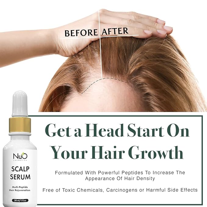 nuorganic Dry Scalp Serum to Hydrate and Moisturize Hair Follicles — Reduce Hair Loss, Flakiness, Dryness and Itch All in One — Vegan & Organic (1 fl.Oz / 30ml)