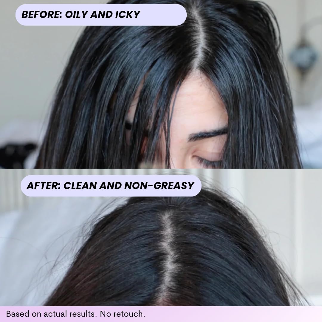 FoxyBae Turned Up Dry Shampoo Spray - Dry Shampoo for Women with Biotin for Hair Growth - Volumizing, Refreshing & Non-Toxic - 7 Fl Oz