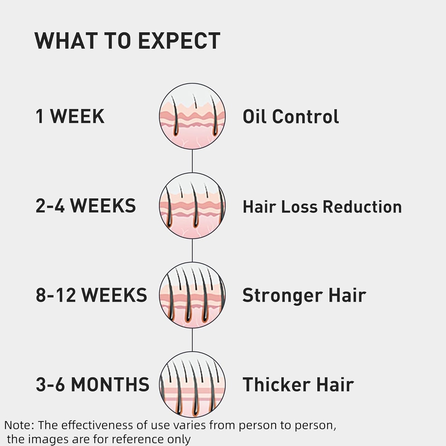 0.9% KX-826 KINTOR Hair Growth Spray,Strengthen Hair Nourish Hair follicles,Hair Care Products for Sparse Hair and Oily Hair Men&Women,180ml,Pro