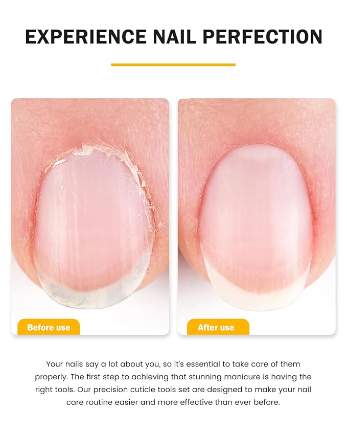 BEZOX Cuticle Trimmer with Pusher - Salon Quality Cuticle Clipper with Cuticle Pushers, Super Sharp Cuticle Cutters and Dual-End Nail Pushers Cuticle Stick, Professional Manicure Tools