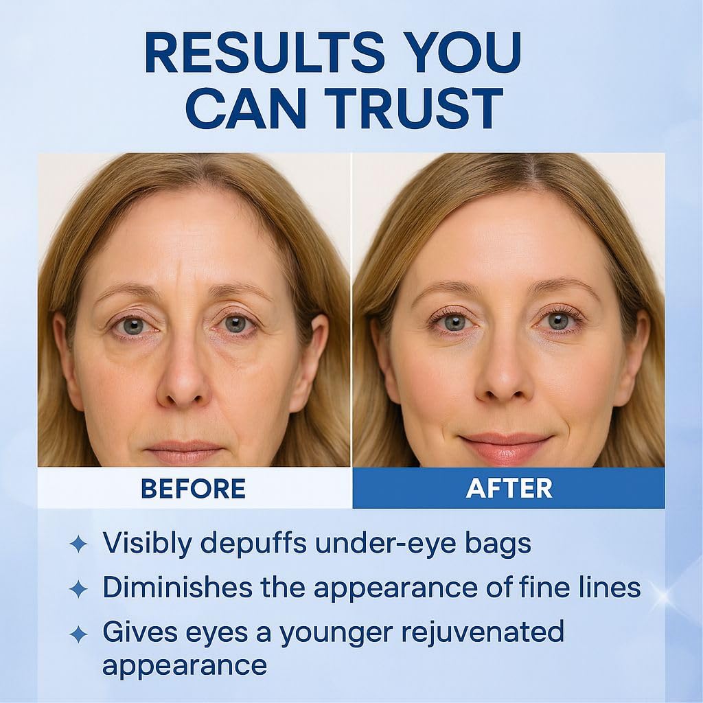 Instant Under Eye Lift Serum – Reduces Puffiness, Eye Bags & Wrinkles in Minutes | Advanced Firming Polysaccharide Formula for Mature Skin | Anti-Aging Under Eyes Treatment 20 mL