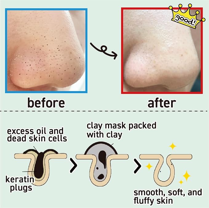 Detoxifying, Pore Minimizing, Hydrating Mask | 98.5% Natural Clay Mask |