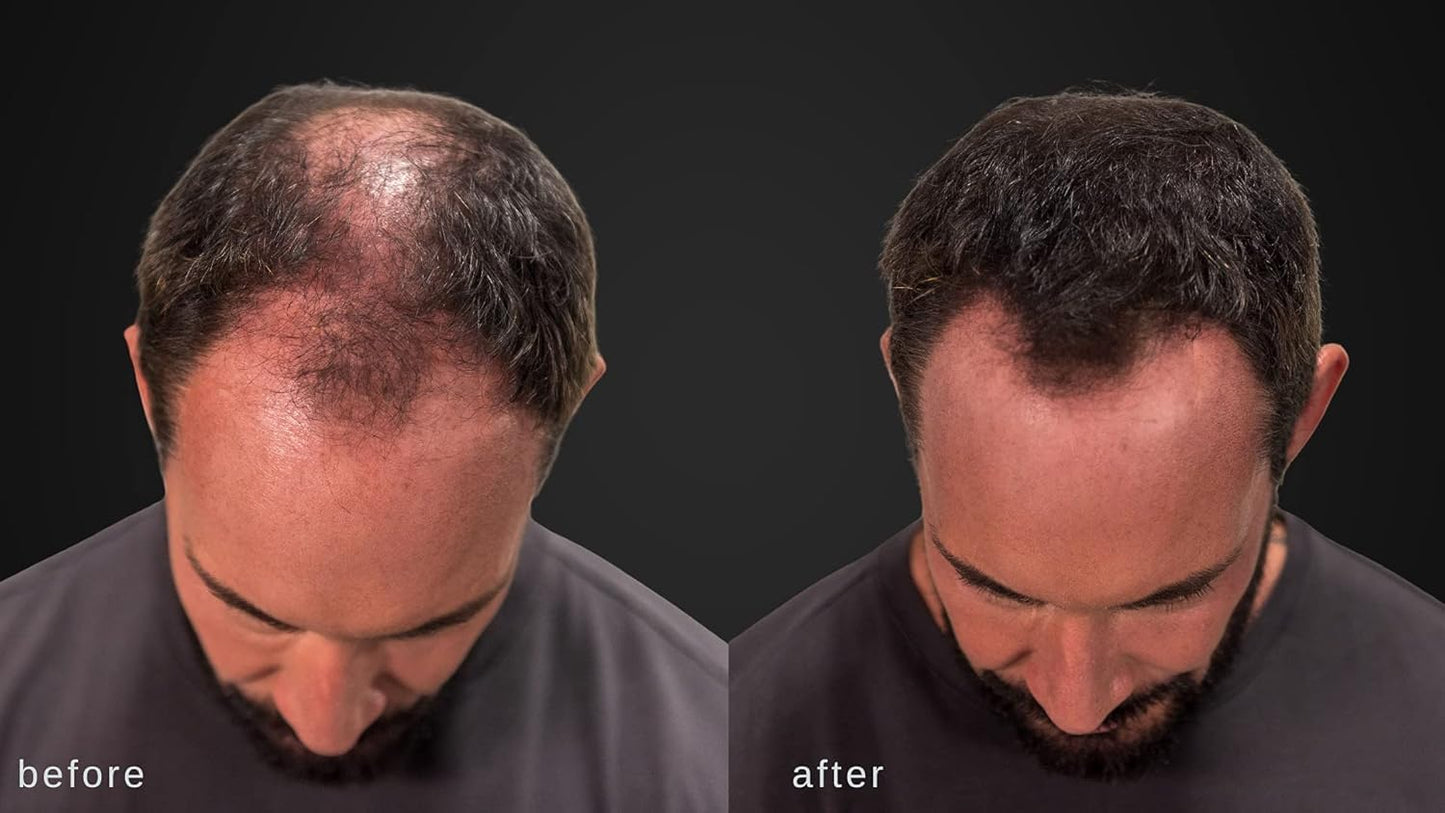 LUXE Hair Building Fibers - Thickening Fibers - CONFIDENCE IN A JAR – 2 Months+ Supply! – Hypoallergenic, Dermatologist Tested – Multiple Colors Available (Auburn)