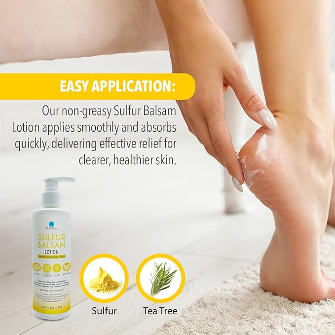Dr. Robaina Sulfur Balsam Lotion – Daily Moisturizing Lotion for Eczema and Psoriasis Relief – Soothes Redness, Hydrates Sensitive Skin – Natural Ingredients – Made in the USA (Pack of 1)