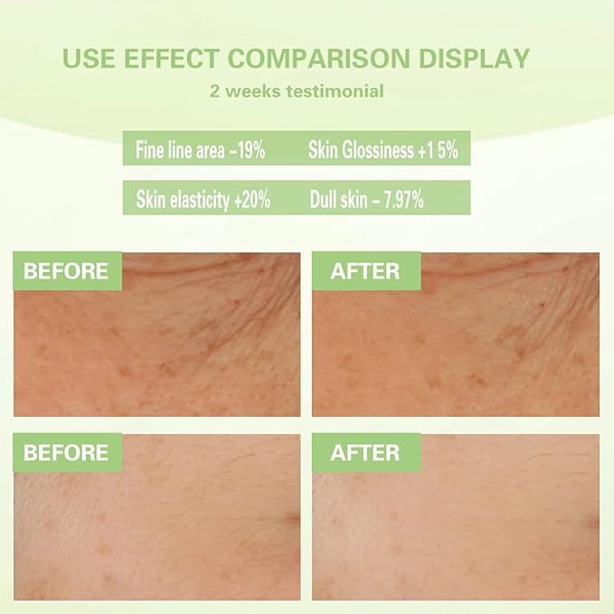 Face Serum for Women,Fruit Facial Serum with 24K Gold Foil and Apple Cell Culture Extract Anti Aging Moisturizer Skin Tone Even Anti Wrinkle Essence for Reduces Dulls & Fine Lines,1.02Fl Oz