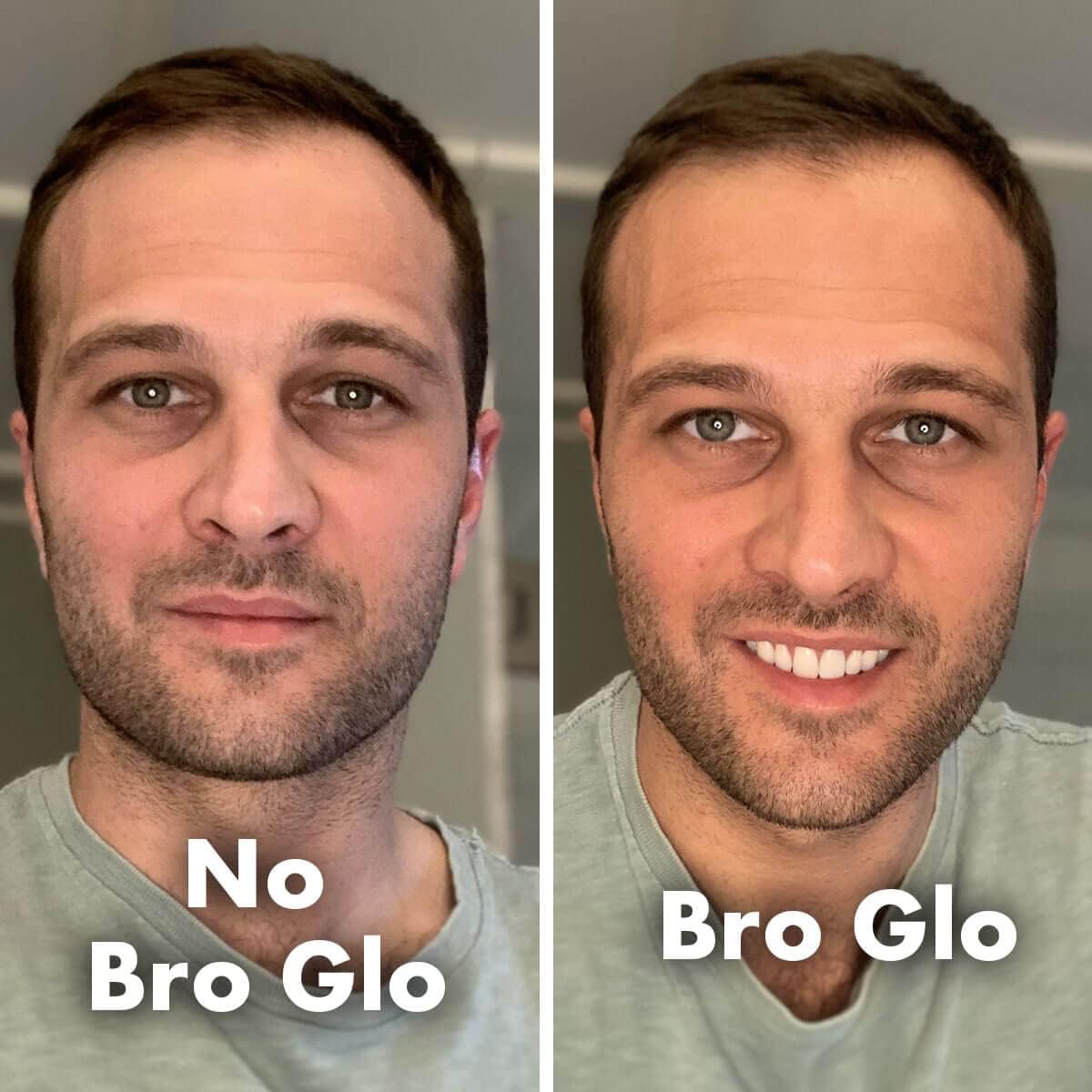 Bro Glo Self Tanner for The Boys - Quick Application Foam Mousse - Easy Sunless Tan For Your Face - Oil Free Water Based for Faster Skin Drying - Natural Sun Kissed Bronze Color Perfect for Men - Beach and Pool Not Required 3.4 FL oz