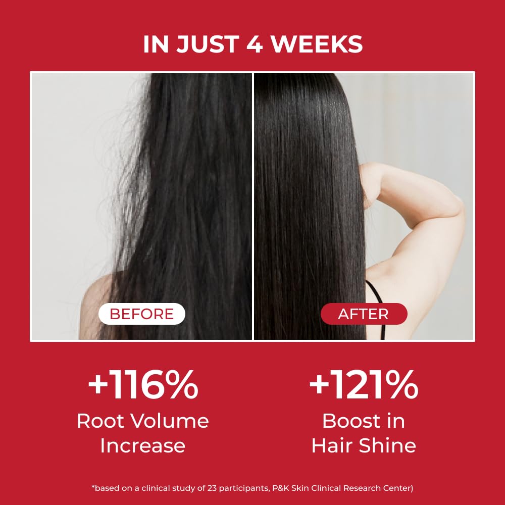 MOEV ANNURCATIN Shampoo | Korean Apple Hair Care for Strength and Volume in Thinning Hair | Adds Lift | Paraben-Free | Suitable for All Hair Types (10.14 fl.oz, apple & vanilla)