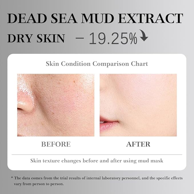 10X Collagen Anti-Aging Sleep Mask – Active Protein Technology – Intensive Hydration, Reduces Sagging & Dullness, Skin Care, Smooth & Whitilight, Cruelty-free (10PCS-Mud Mask-Dead sea mud White)