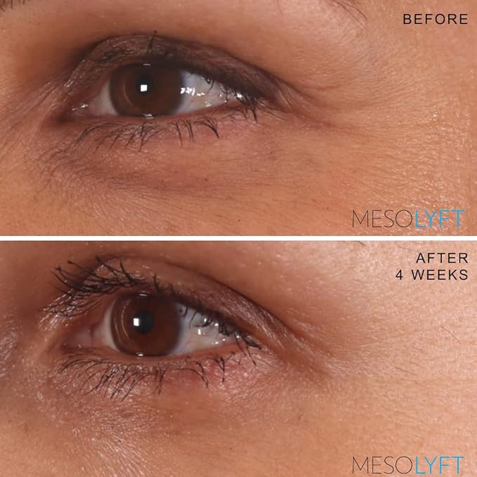 Neck & Eyes Combo Skincare Tool under Eye Serum With Neck Line Remover Neck and Décolletage Beuty Tool & Under Eye Wrinkle Filler Exfoliates the Skin, Visibly Firm & Smooth Necklines