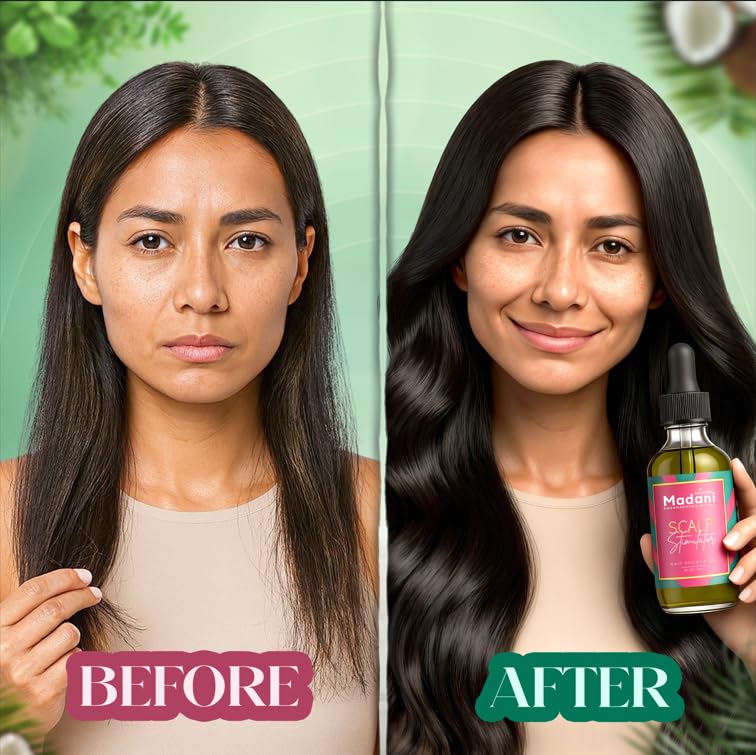 Madani Naturals Scalp Stimulator Hair Growth Oil With Rosemary Oil & Mint - Hair Loss Treatment for Split End and Dry Scalp for All Hair Types, Strengthen Hair and Stop Hair Loss, 2-Fluid Ounces