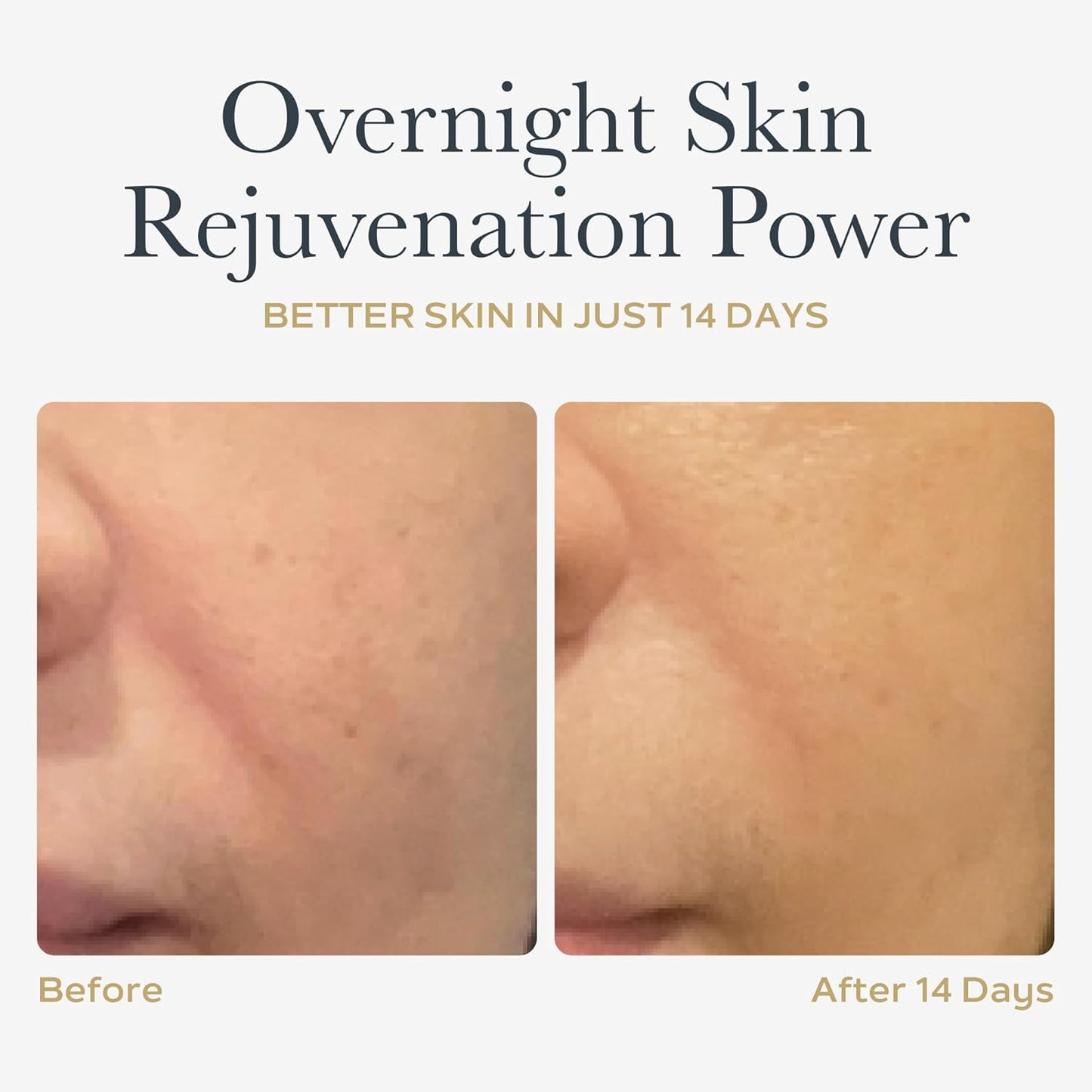 SOTHYS Renovative Micro-Capsules - Vitamin C Serum for Face | Vegan Capsules | Anti-Aging, Dark Spot | Night Treatment | 60 x .01 Fl Oz