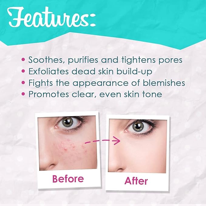 Bye Bye Blemish Skin Resurfacing Regimen Set, with Witch Hazel & Tea Tree Skin Toner, Skin Resurfacing Peel Serum, and Skin Rescue Serum with Niacinamide and Zinc, Cruelty-Free, Bundle Pack