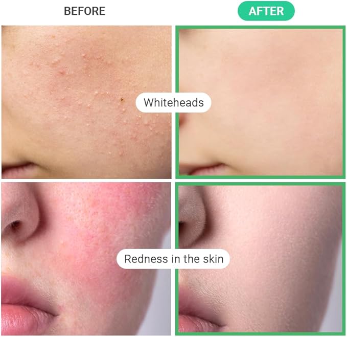 TENZERO Heart Leaf CICA Essence Heart Pad 50ea, Redness Relief Soothing Pore Care for Sensitive Skin, Korean Facial Toner Pads, Hydrating & Refreshing, Centella, 150g