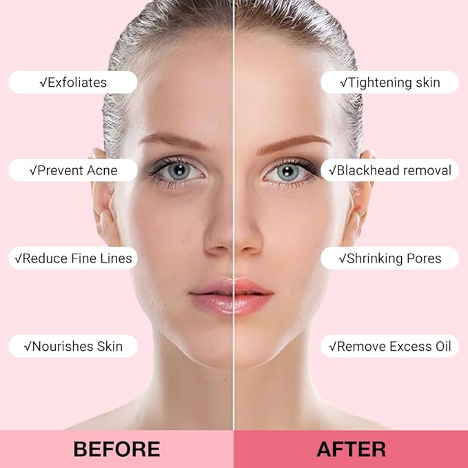 Vitamin C Clay Mask For Face, With Turmeric and Kaolin Clay, Deep Cleansing Pores, Face Masks Skincare for Refining Pores and Controlling Oil, Black Head Remover (Strawberry)