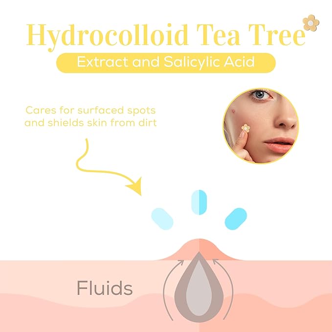 My Beauty Spot Pimple Patches Cute Acne Patches for Face (140 Patches) with Hydrocolloid, Tea Tree Extra & Salicylic Acid, Colorful Fun Designs – Pimple Patches for Face Acne Spot Treatment