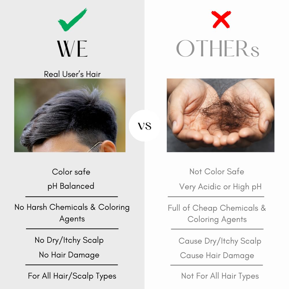 K C Scalp Detox & Hair Treatment Mask - Deep Conditioner for Dry Scalp & Damaged Hair – Scalp Care for Buildup, Flakes & Oil Control – All Hair/Scalp Types – Spa Grade Formula (MEN)