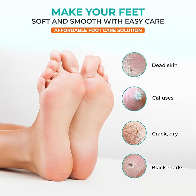 Happy Feet Foot Peel Mask Coconut, 03 Packs Original Exfoliant Foot Peel Mask, Callus Remover for Rough Cracked Dry Feet Dead Skin