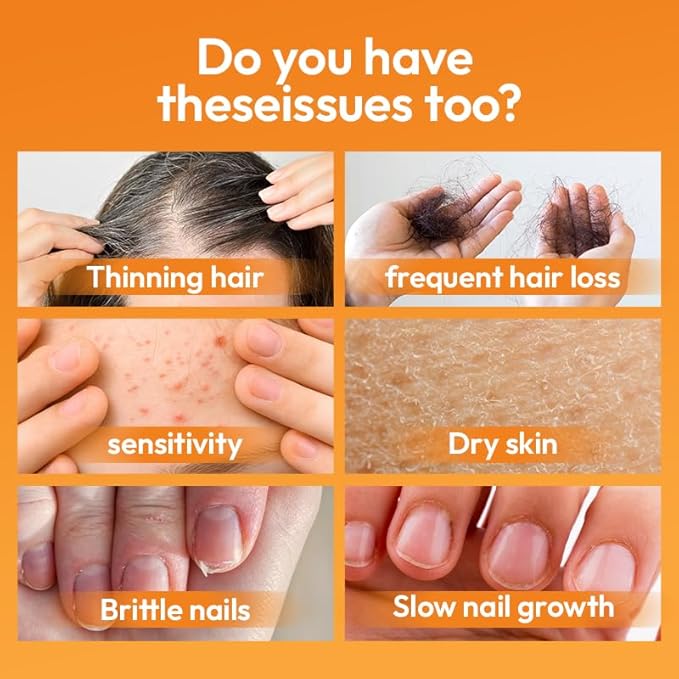 Biotin 10000 mcg with Zinc, Vitamin C & Calcium Pantothenate – Supports Healthy Hair Growth, Strong Nails & Glowing Skin for Women & Men | Made in The USA | 180 Vegan Capsules (6 Months Supply)