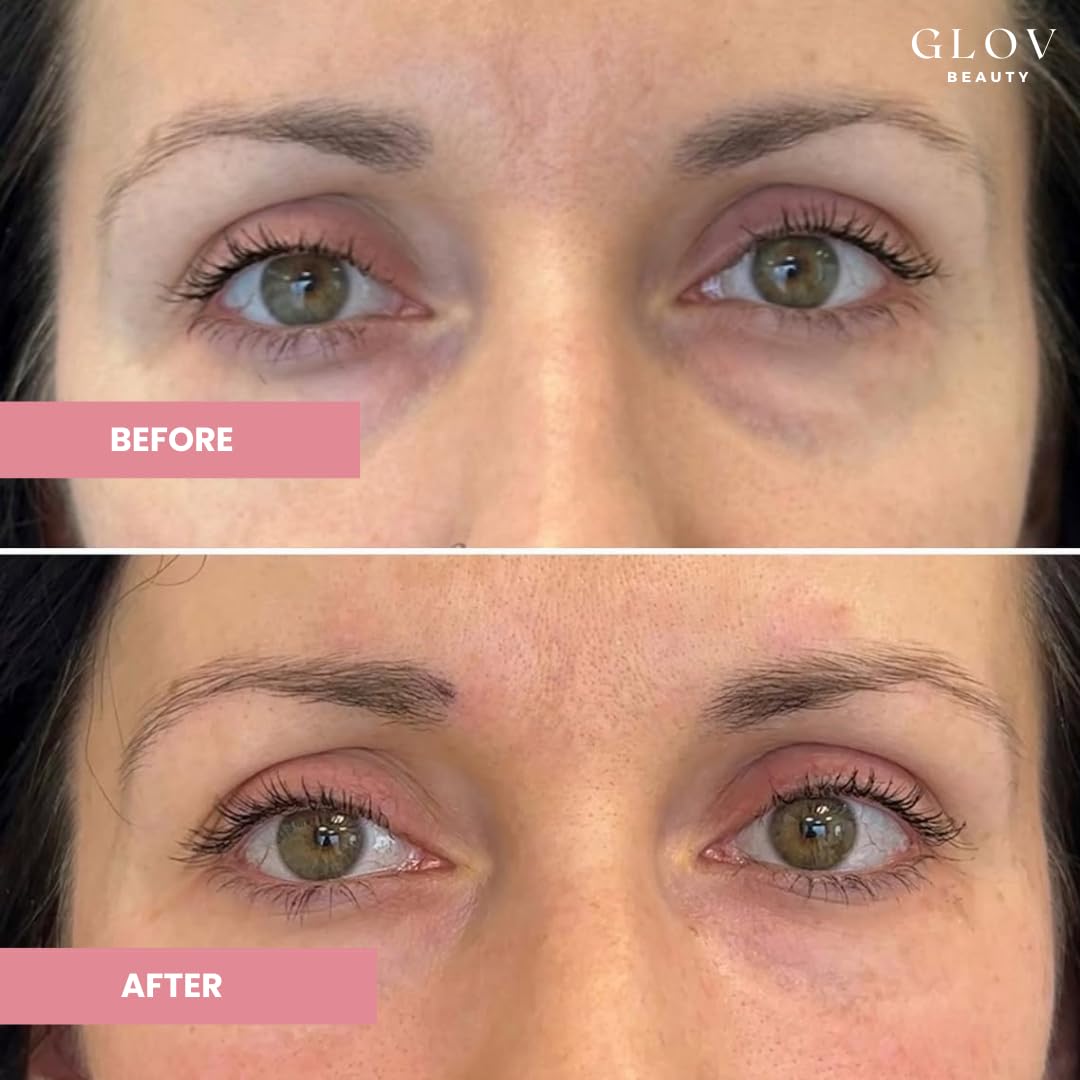 Glov Beauty - Hydrate & Brighten Eye Cream - Anti-Aging Under Eye Cream for Dark Circles, Wrinkles & Puffiness - With Retinyl Palmitate, Sodium Hyaluronate & Niacinamide - All Skin Types