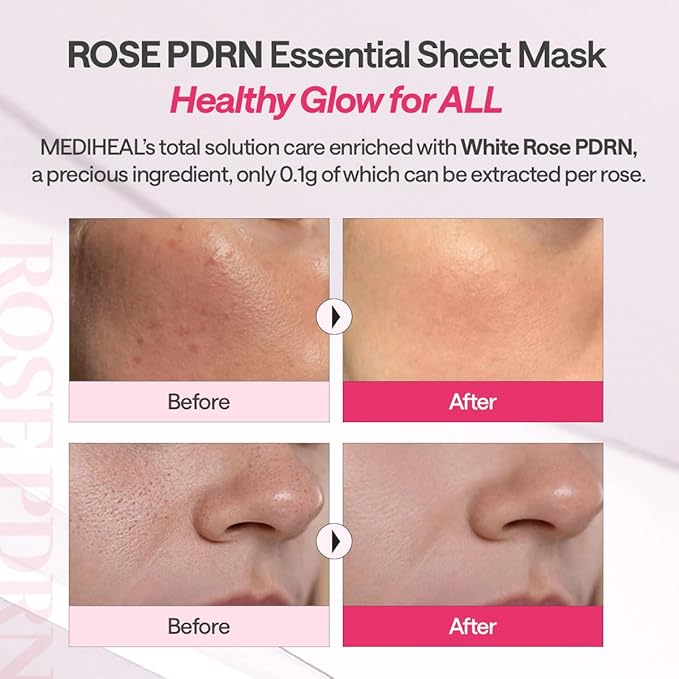 Mediheal Rose PDRN Essential Sheet Mask 4 pcs. 99% Pure White Rose PDRN & Hyaluronic Acid for hydrating, firming, and enhancing moisture barrier, skin firmness, and glow. Vegan formula.
